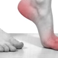 Can you rub cbd oil on your feet for neuropathy?