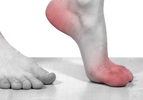 Can you rub cbd oil on your feet for neuropathy?